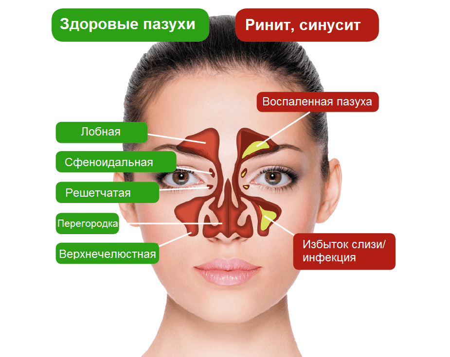 Картинки при насморке