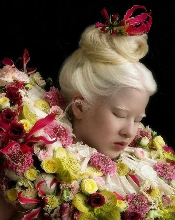 Кинута в дитинстві через альбинизма Сюелі виросла, щоб стати моделлю Vogue